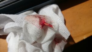 The barley grass was removed from Bella’s foot with the help of some comfrey leaves. PHOTO/SUPPLIED