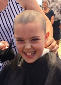 Lily Allan after her head was shaved. PHOTO/SUPPLIED
